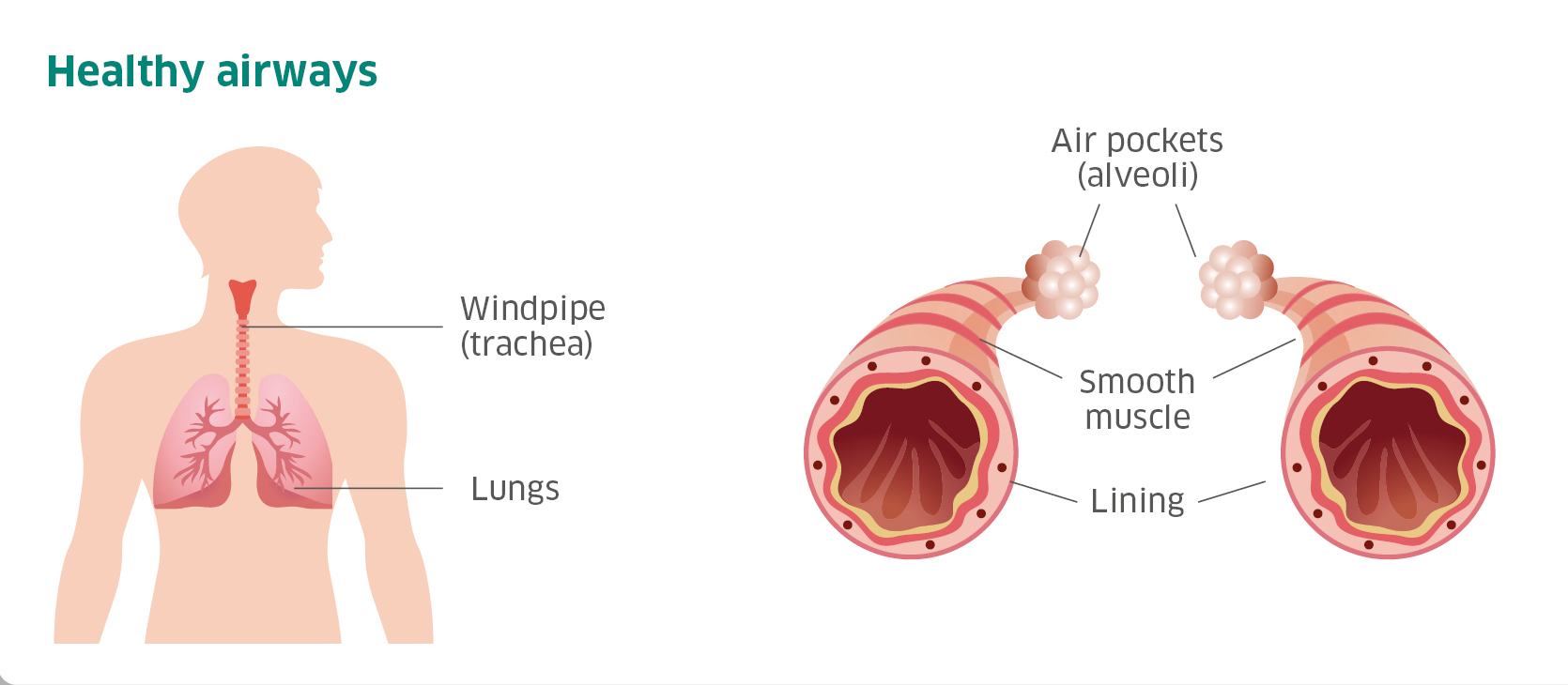 Healthy airways image