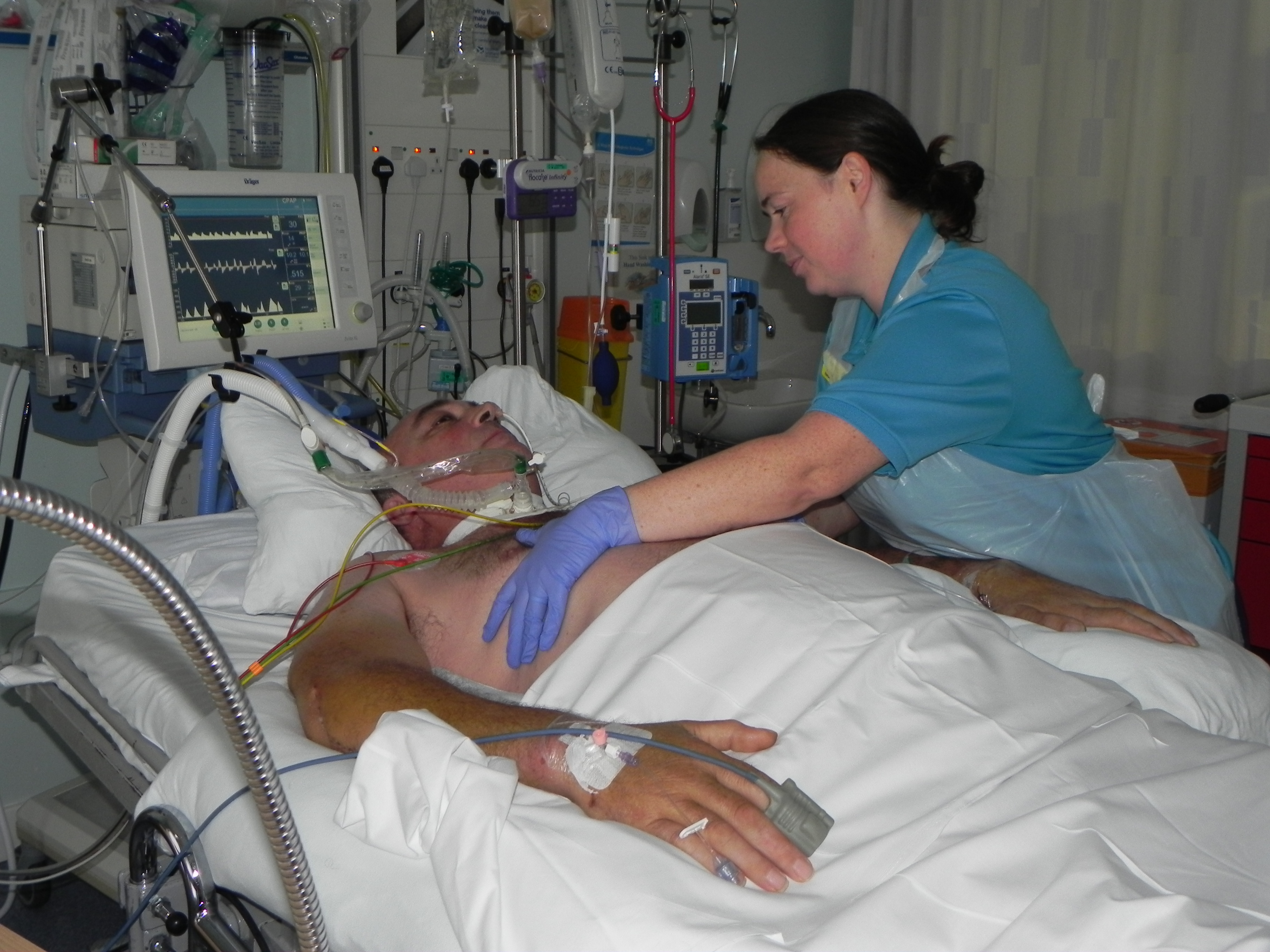 Ventilated patient